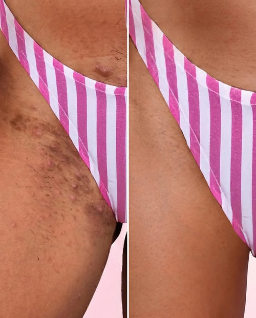 Bella Skin 3 en 1 – Loción Corporal Hidratante y Aclarante - additional image 1